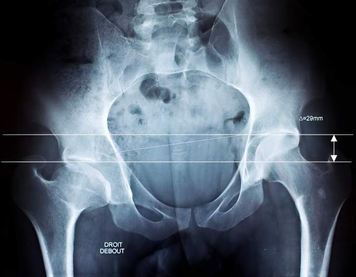 Radiographie ILMI Paris