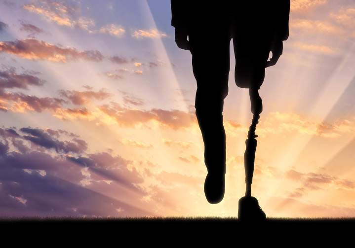 Prothèse orthopédique Paris